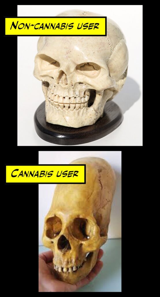 heads cannabis